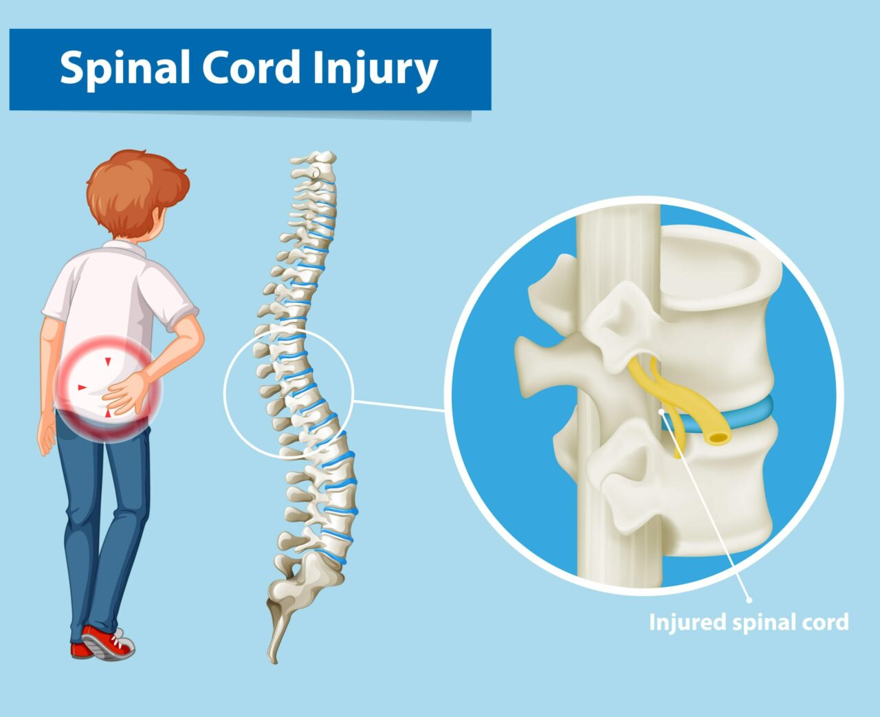 CBD For Spinal Cord Injury