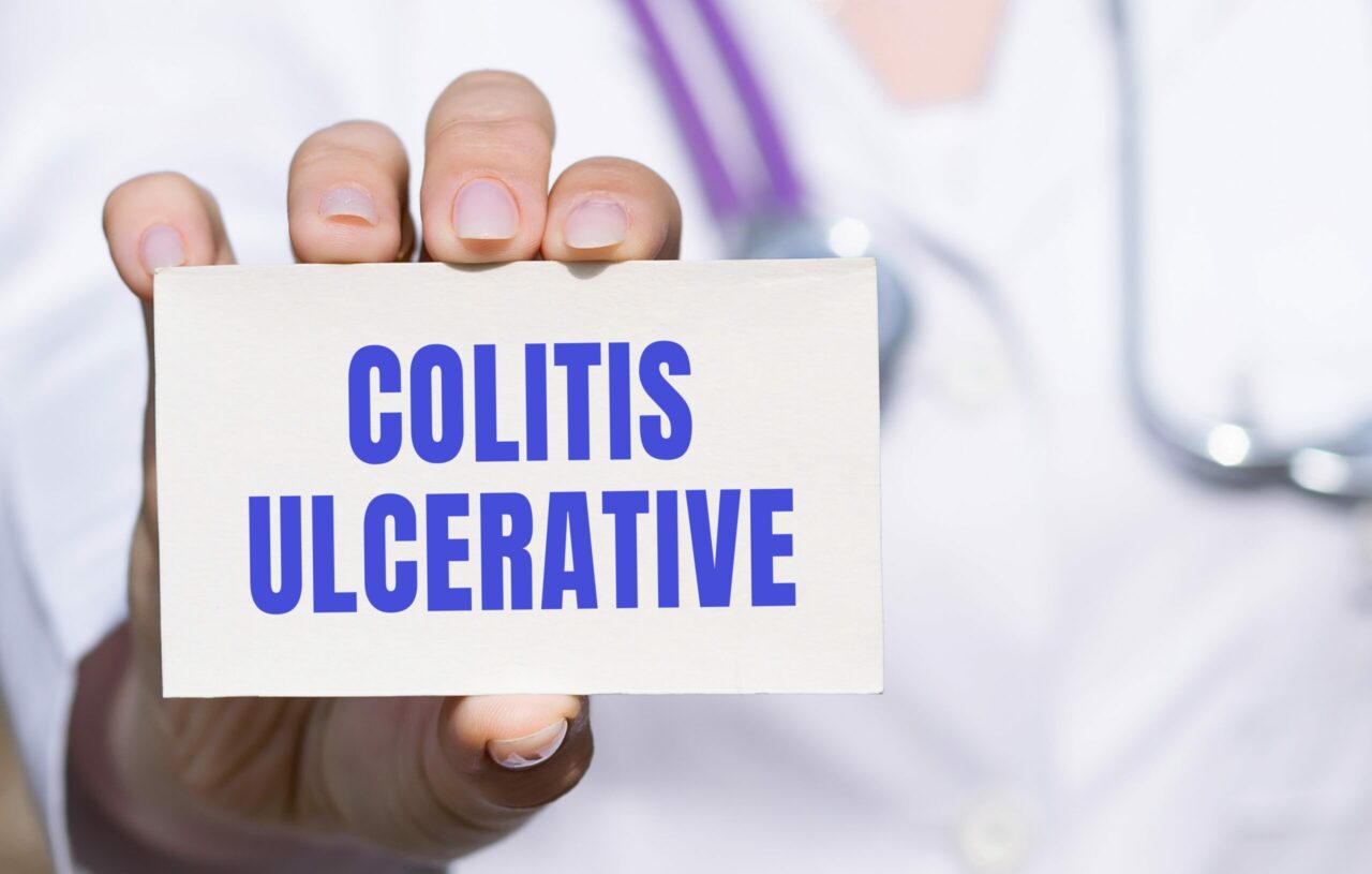 CBD For Ulcerative Colitis