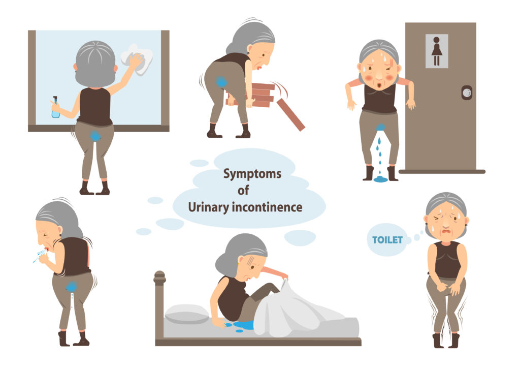CBD For Stress Incontinence