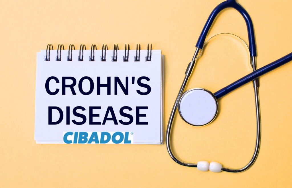 CBD For Crohn's Disease