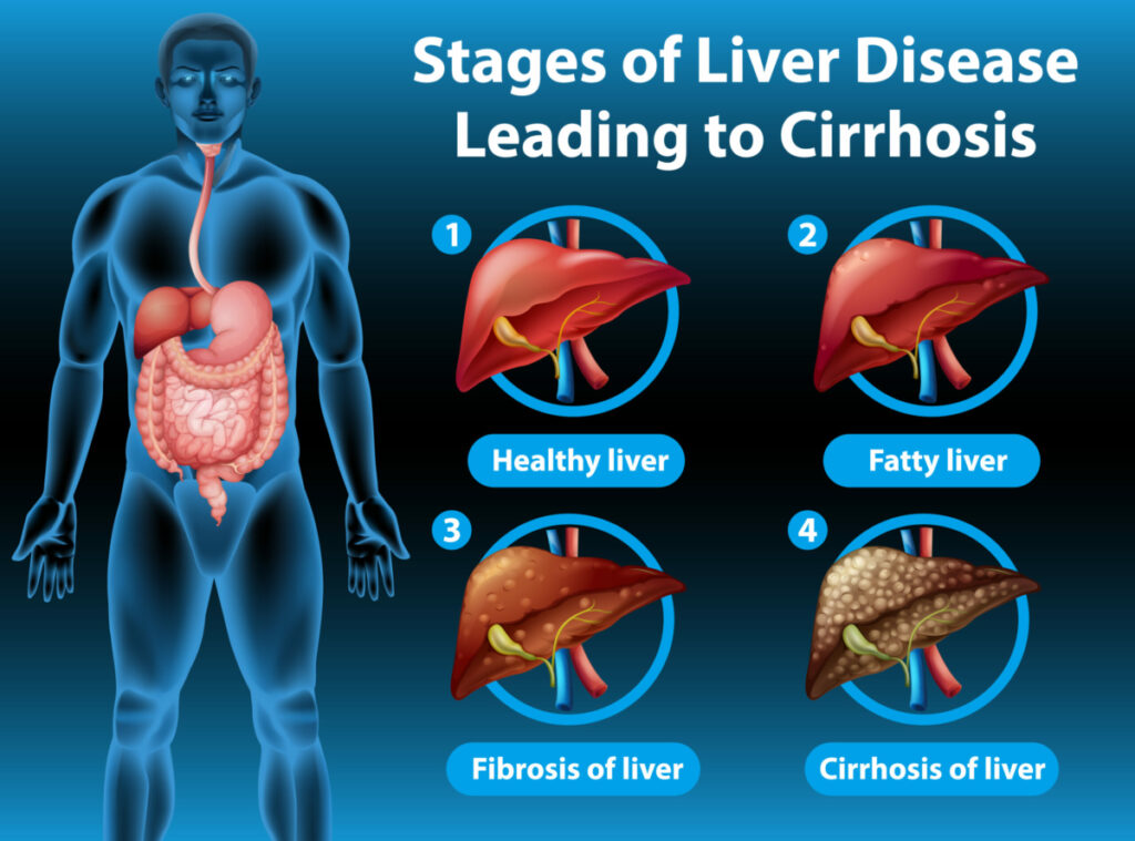 CBD For Liver Diseases