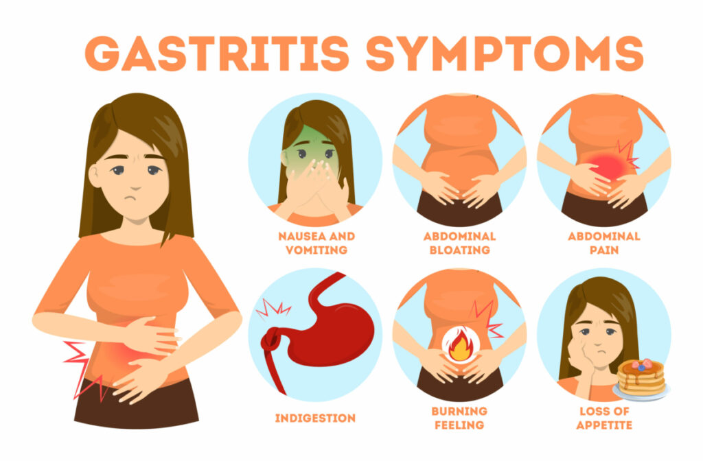 CBD For Gastritis