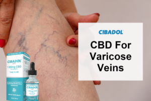 CBD And Varicose Veins
